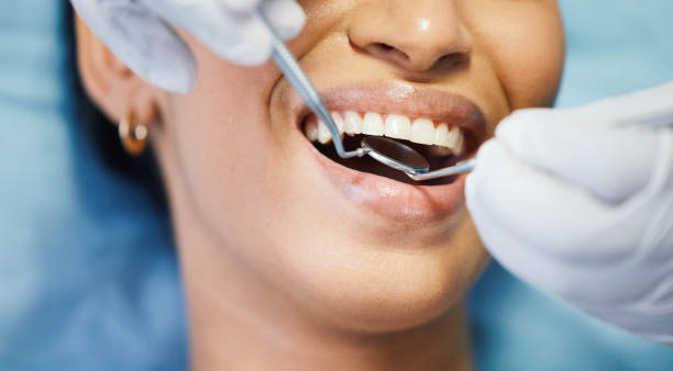 Best Emergency Gum Treatment in Lowry Crossing, TX