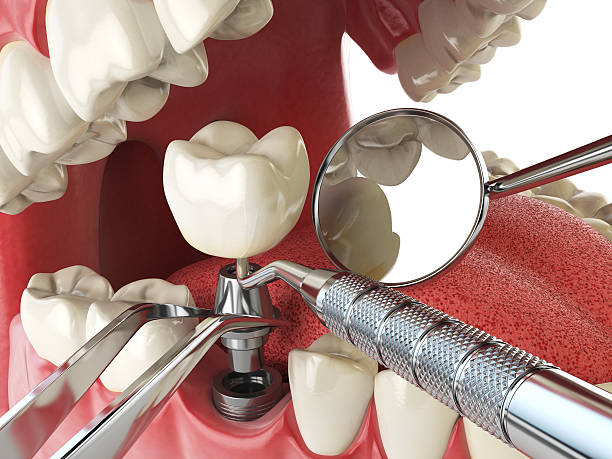 Best Cosmetic Emergency Dentistry in Lowry Crossing, TX