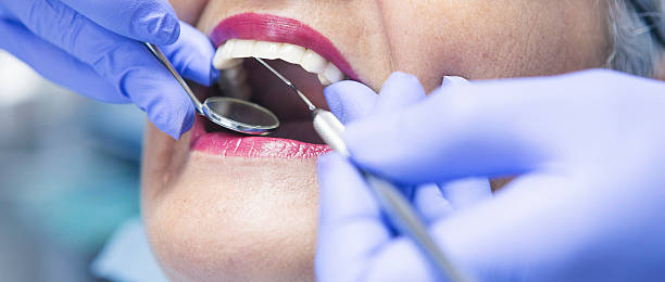 Best Emergency Wisdom Teeth Removal in Lowry Crossing, TX